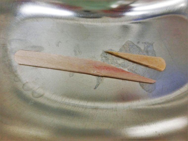 アイスクリームの棒誤食（内視鏡により摘出）-希望ヶ丘動物病院